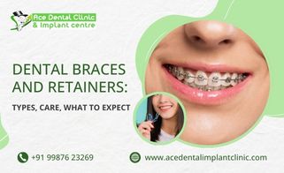 Dental Braces and Retainers: Types, Care, What to Expect