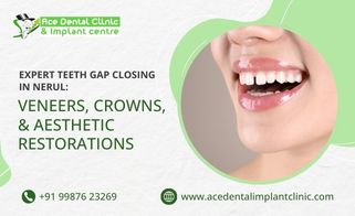 Expert Teeth Gap Closing in Nerul: Veneers, Crowns, and Aesthetic Restorations