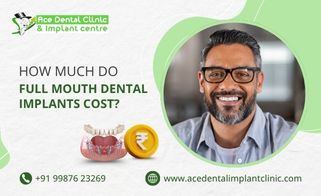How Much Do Full Mouth Dental Implants Cost?