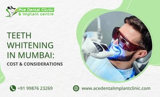 Teeth Whitening in Mumbai: Cost and Considerations