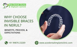 Why Choose Invisible Braces in Nerul? Benefits, Process, and Expectations